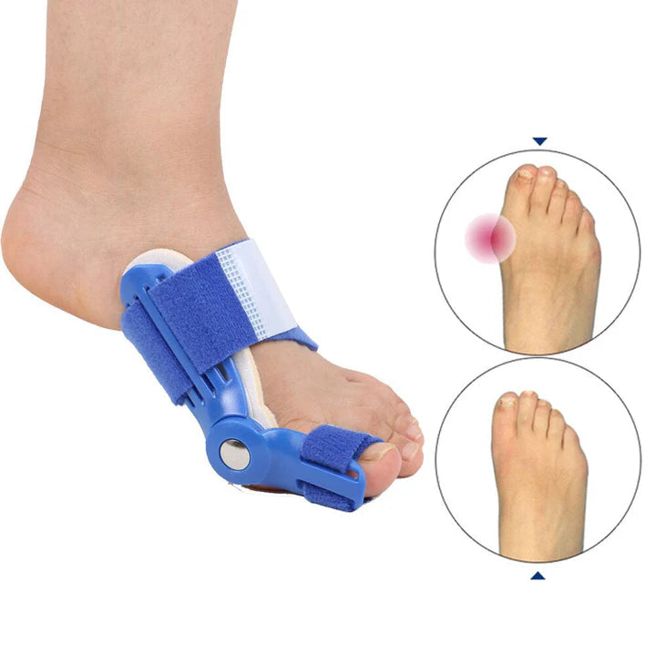 Hallux-Valgus-Korrekturschiene (1 Paar)