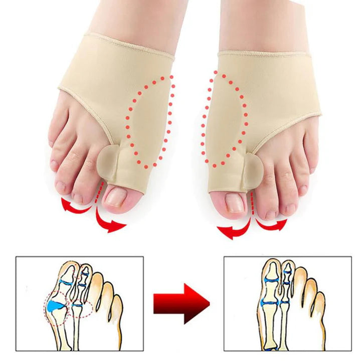 Hallux-Valgus-Korrekturschutz (1 Paar)